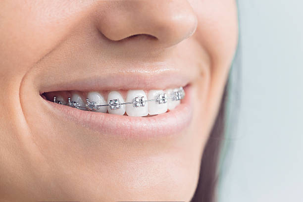 Best Traditional Braces  in Allendale, CA